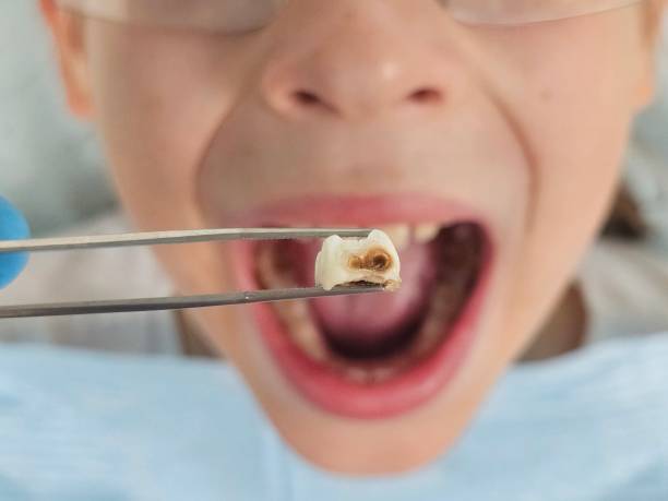 Best Emergency Treatment for Toothache in New River, AZ
