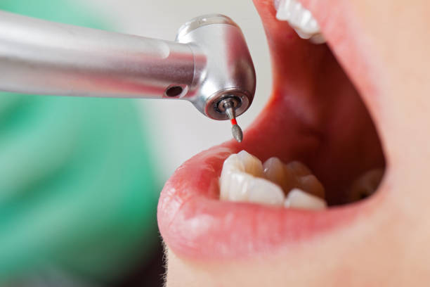 Best Emergency Tooth Extraction in New River, AZ